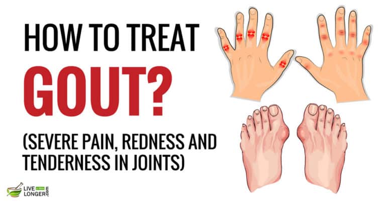 10 Best Home Remedies For Gout That Offer Relief