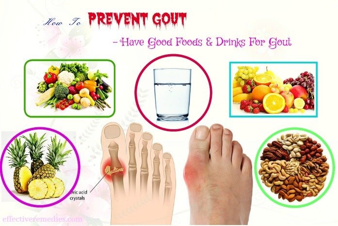 11 Unexpected Tips How To Prevent Gout Flares From Getting ...