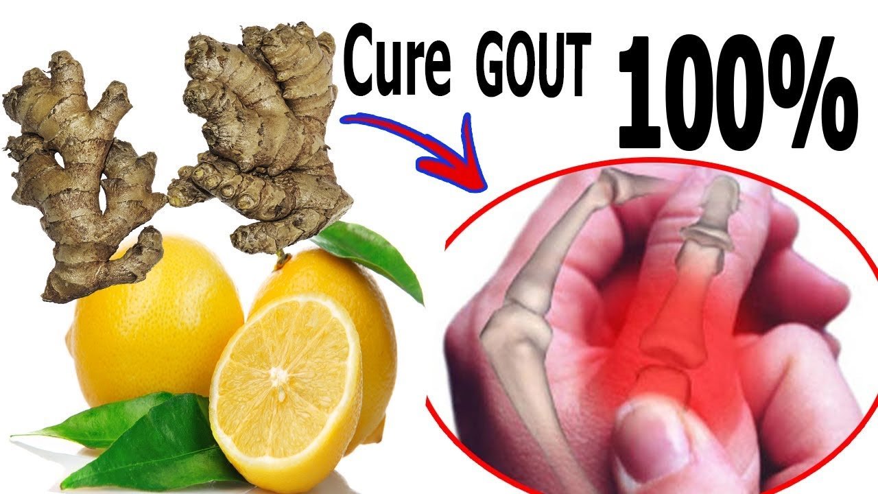 12 Remedies To Cure Gout And Gout Pain At Home