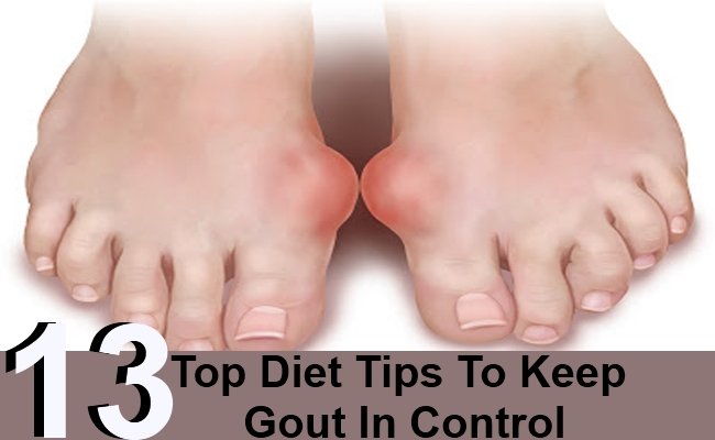 13 Top Diet Tips To Keep Gout In Control