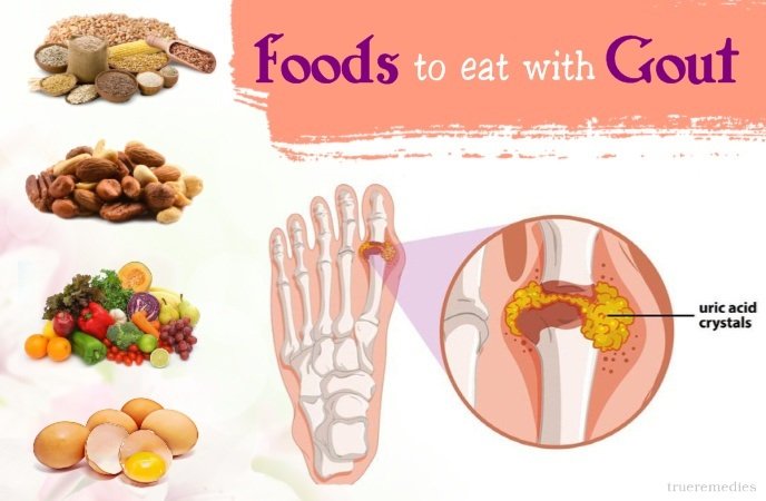 15 Gout Diet Dos And Donts That You Should Not Miss