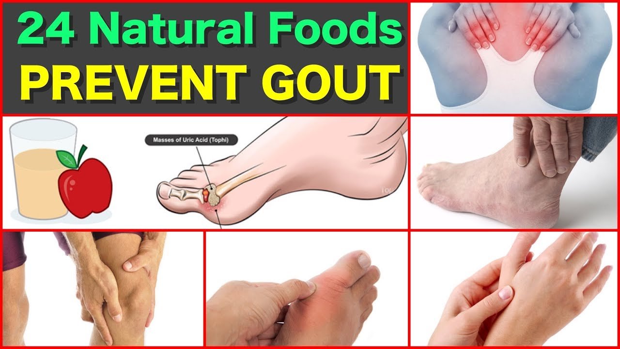 24 Natural Foods to Prevent/REDUCE Gout PAIN/ATTACK Naturally. FAST ...