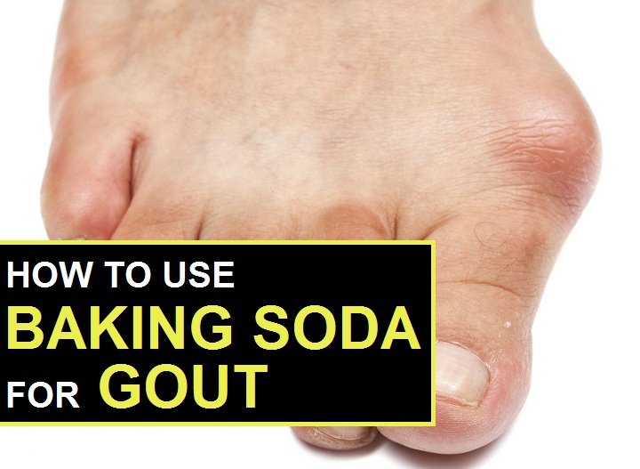 3 Easy Ways to Treat Gout with Baking Soda