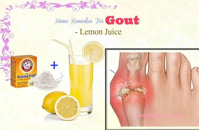 38 Home Remedies For Gout In Foot, Shoulder, Wrist, Leg ...
