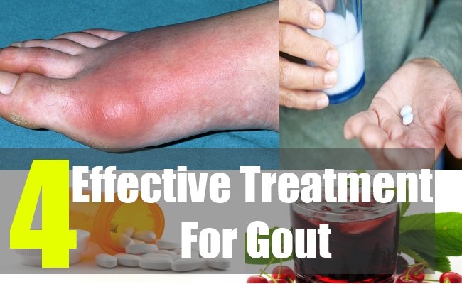4 Effective Treatment For Gout