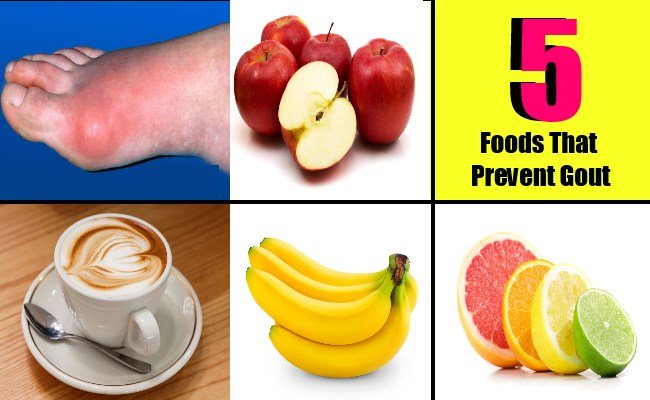 5 Foods That Prevent Gout