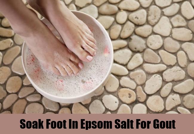 5 Gout In Foot Home Remedies, Natural Treatments And Cures ...