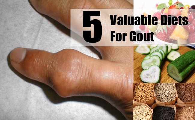 5 Valuable Diets For Gout