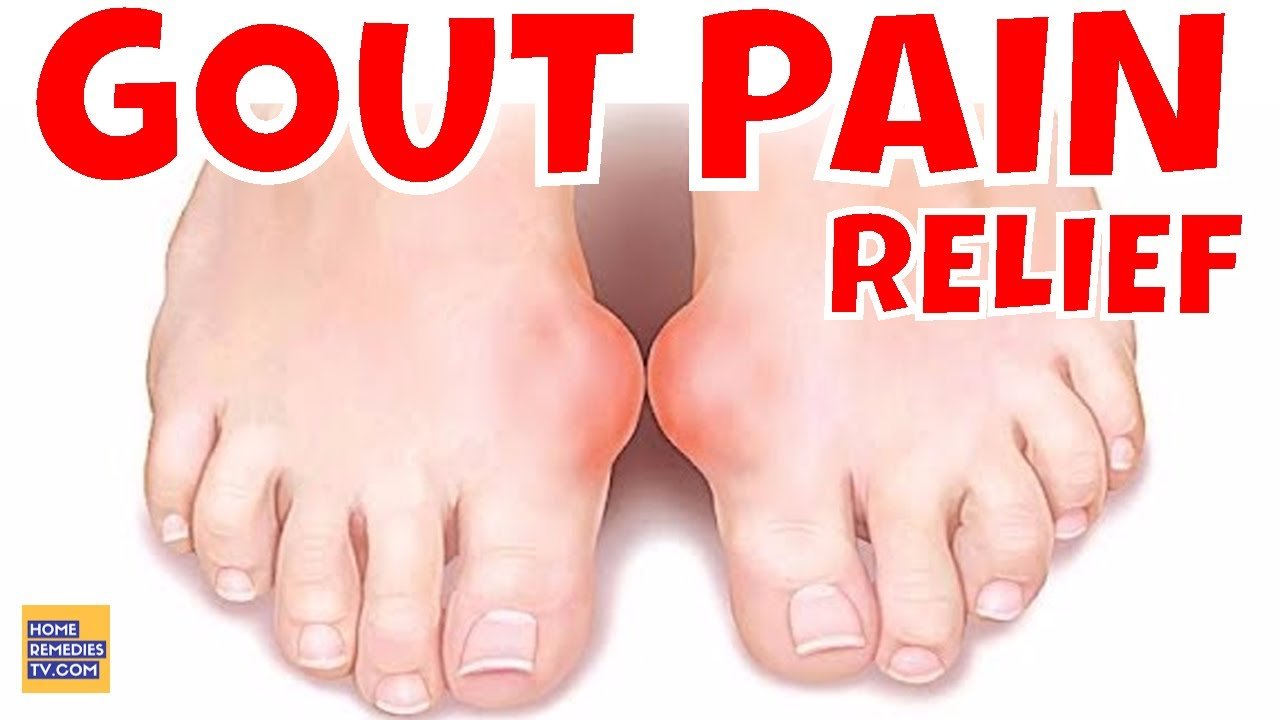 6 NATURAL Ways to REDUCE GOUT PAIN, GOUT ATTACK Naturally ...