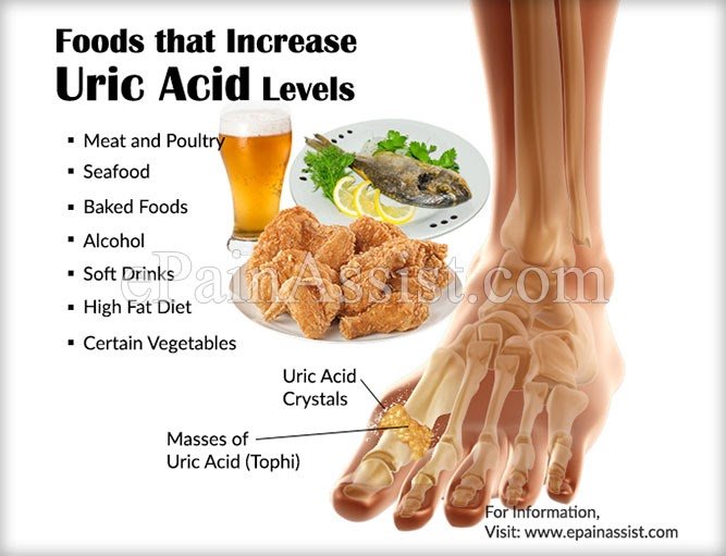 7 Foods that Increase Uric Acid Levels â Step To Health ...