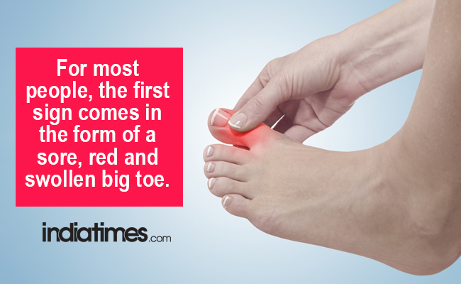 7 Health Conditions That Your Feet Can Warn You About ...