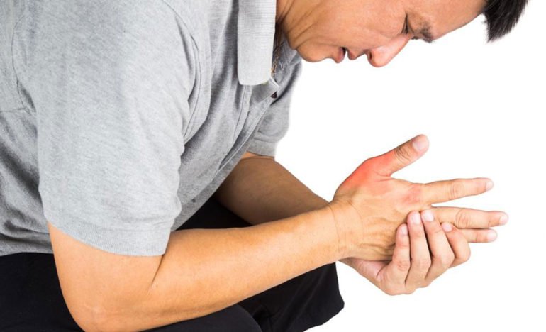 8 Home Remedies For Treating Gout » HealthPixie
