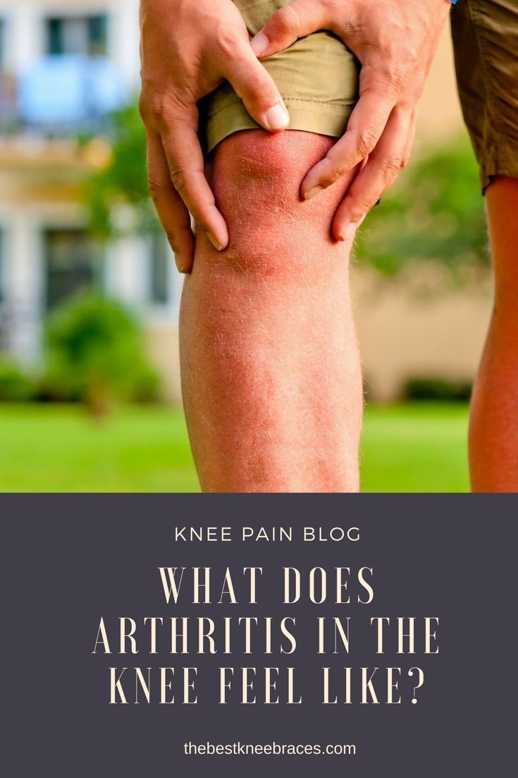 âArthritis is a very common name used to describe ...