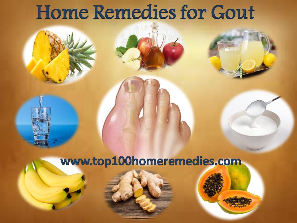 Acute Gout Treatment