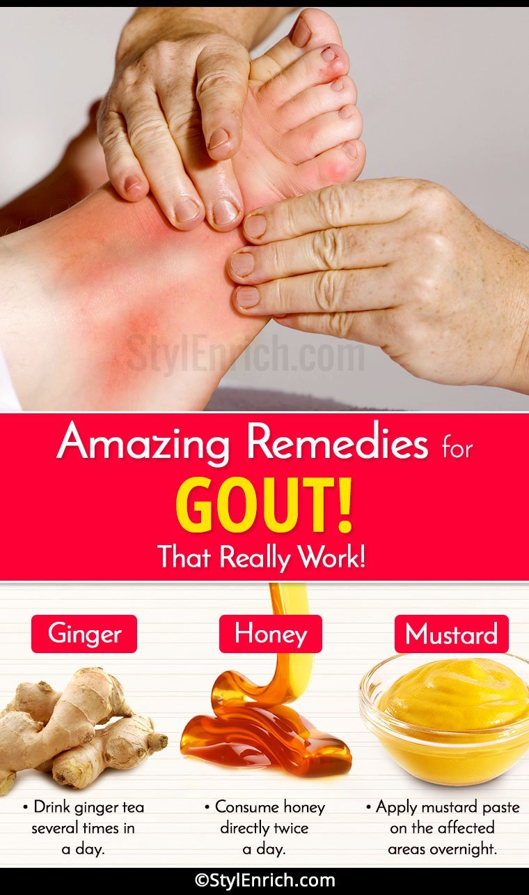 Amazing Home Remedies For Gout That Really Work! â StylEnrich