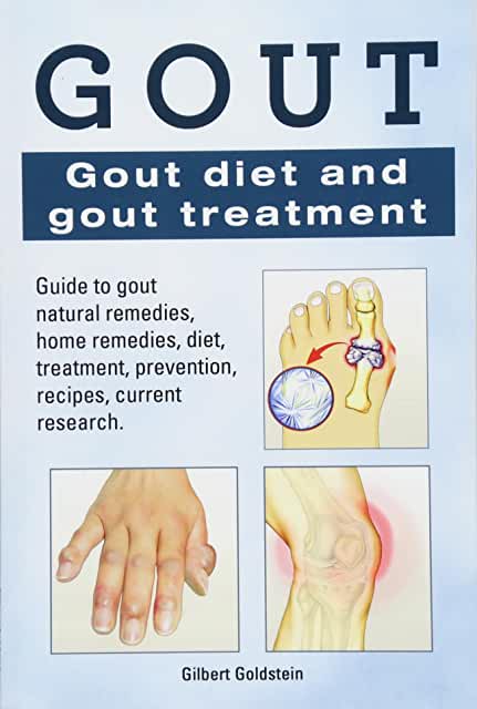 Amazon.com: treatment for gout