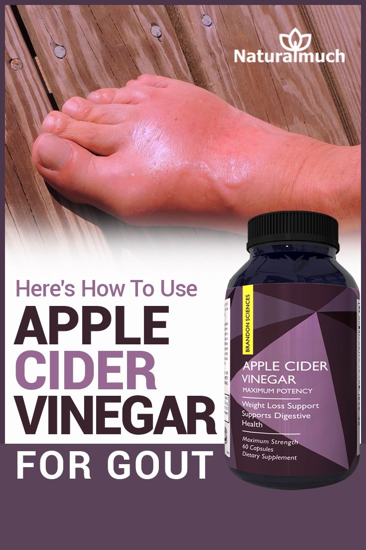 Apple Cider Vinegar for Gout: Here