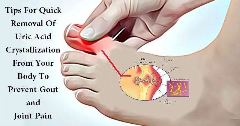 Arthritis in the bones in the feet is often caused by malfunction of ...