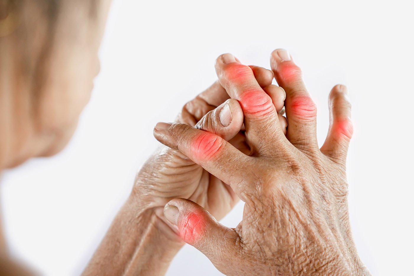 Asian woman hand suffering from joint pain with gout in ...