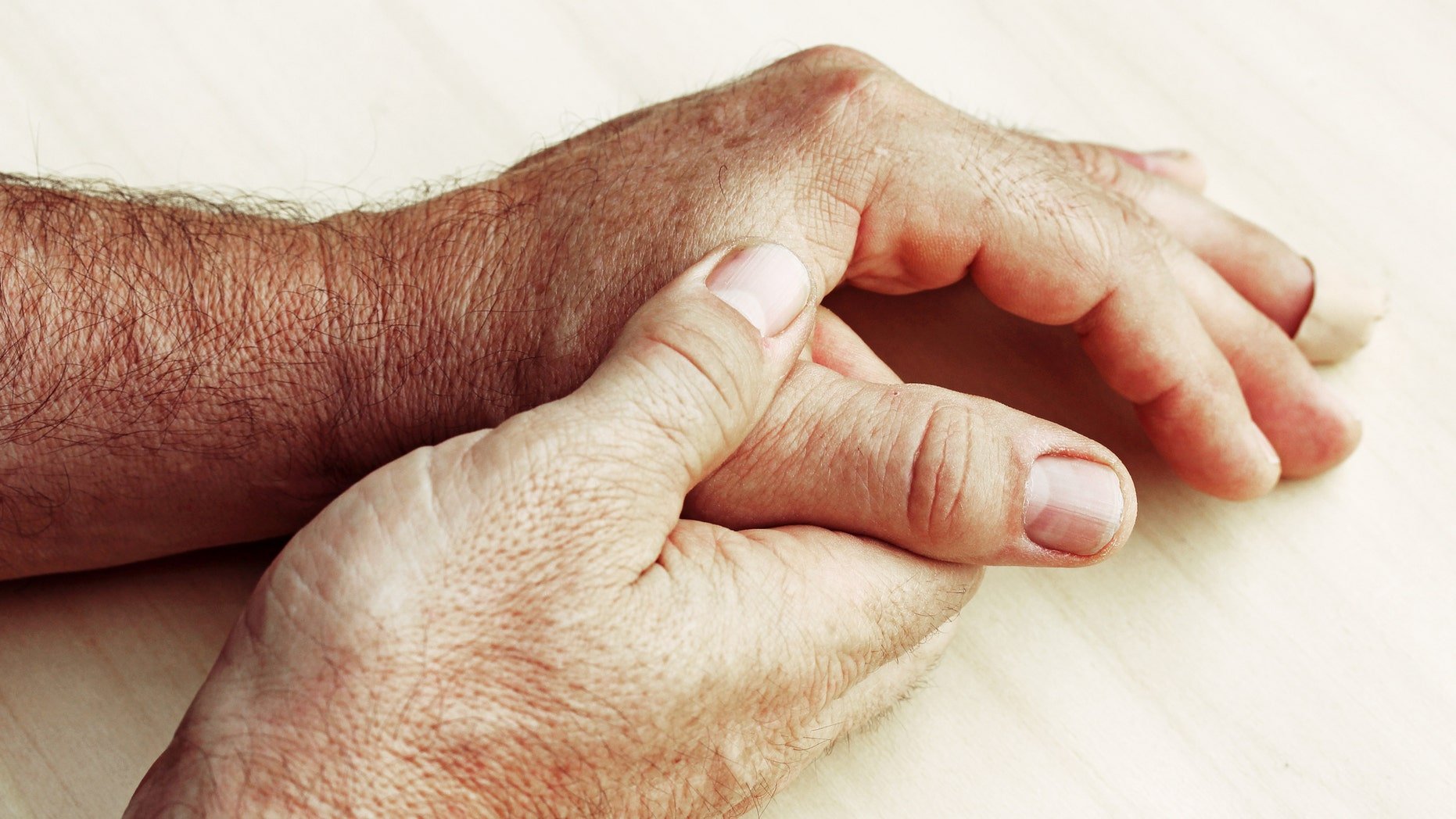 Battle erupts over how to treat gout, no longer the ...