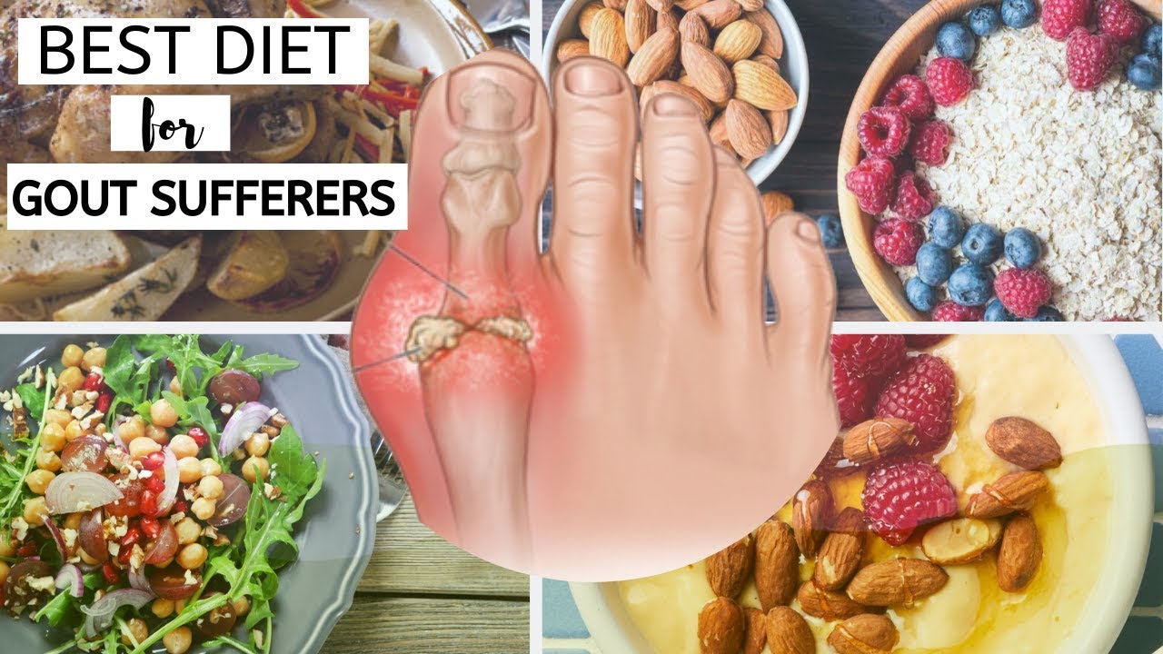 Best Diet for Gout Sufferers