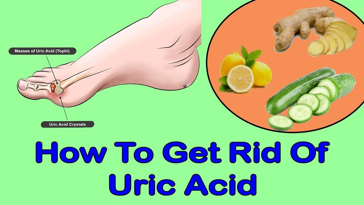 Best Way To Get Rid Of Uric Acid From Your Joints ...