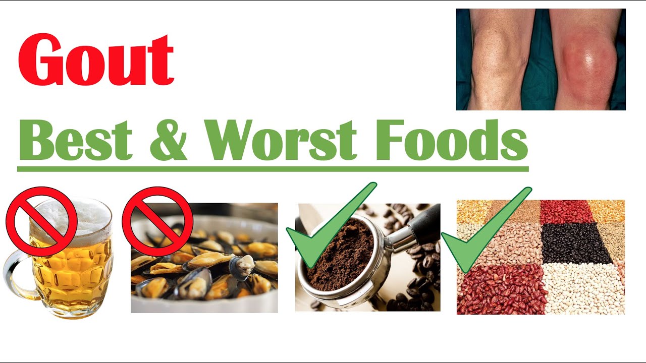 Best &  Worst Foods to Eat with Gout
