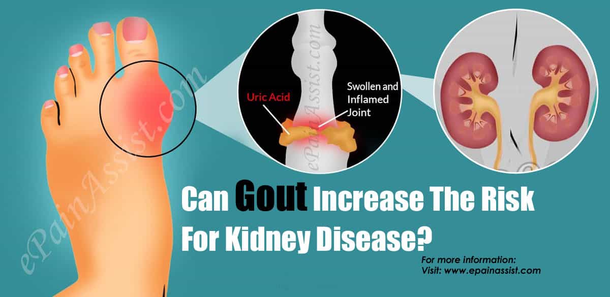 Can Gout Increase The Risk For Kidney Disease?