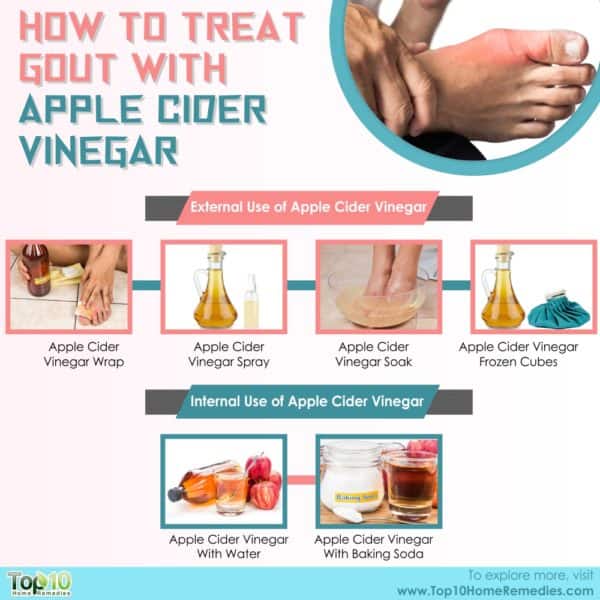 Can You Treat Gout with Apple Cider Vinegar?