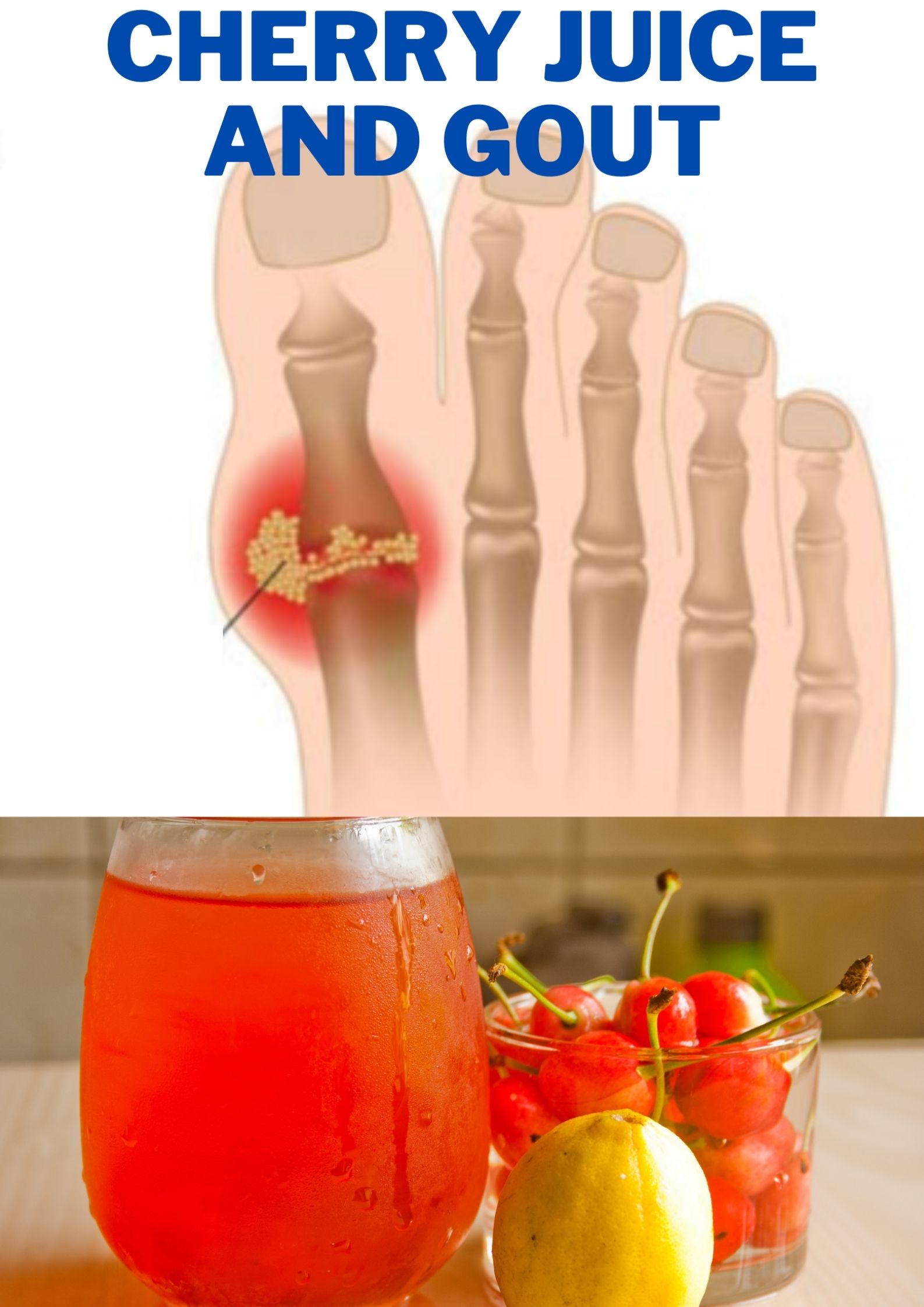 Cherry Juice and Gout