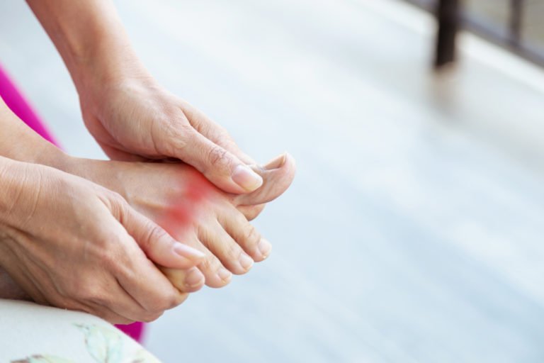 Dealing with Gout Pain