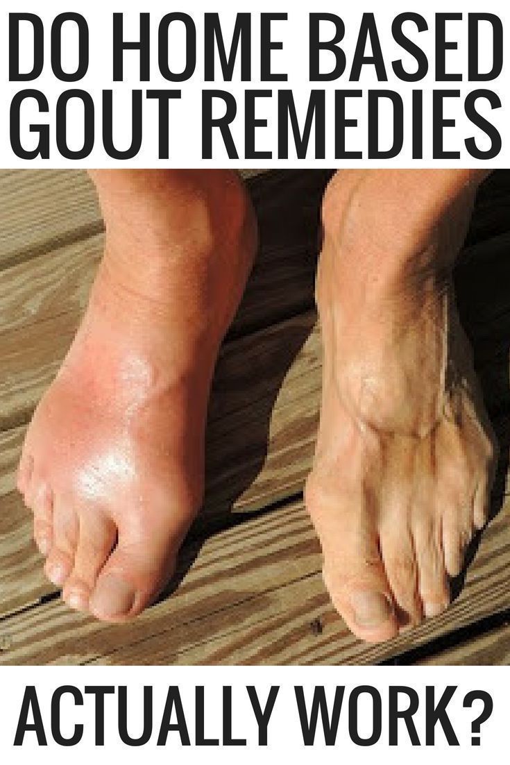 do home based gout remedies actually work? gout remedies ...
