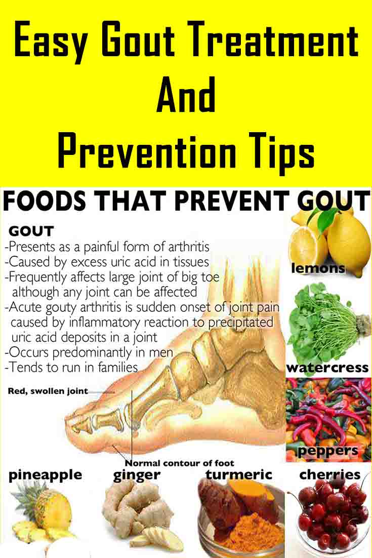 Easy Gout Treatment and Prevention Tips: Easy Gout ...