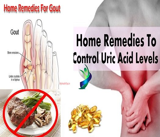 Easy Home Remedies to Control Uric Acid Levels &  Gout