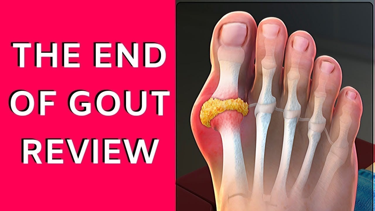 End Of Gout Review