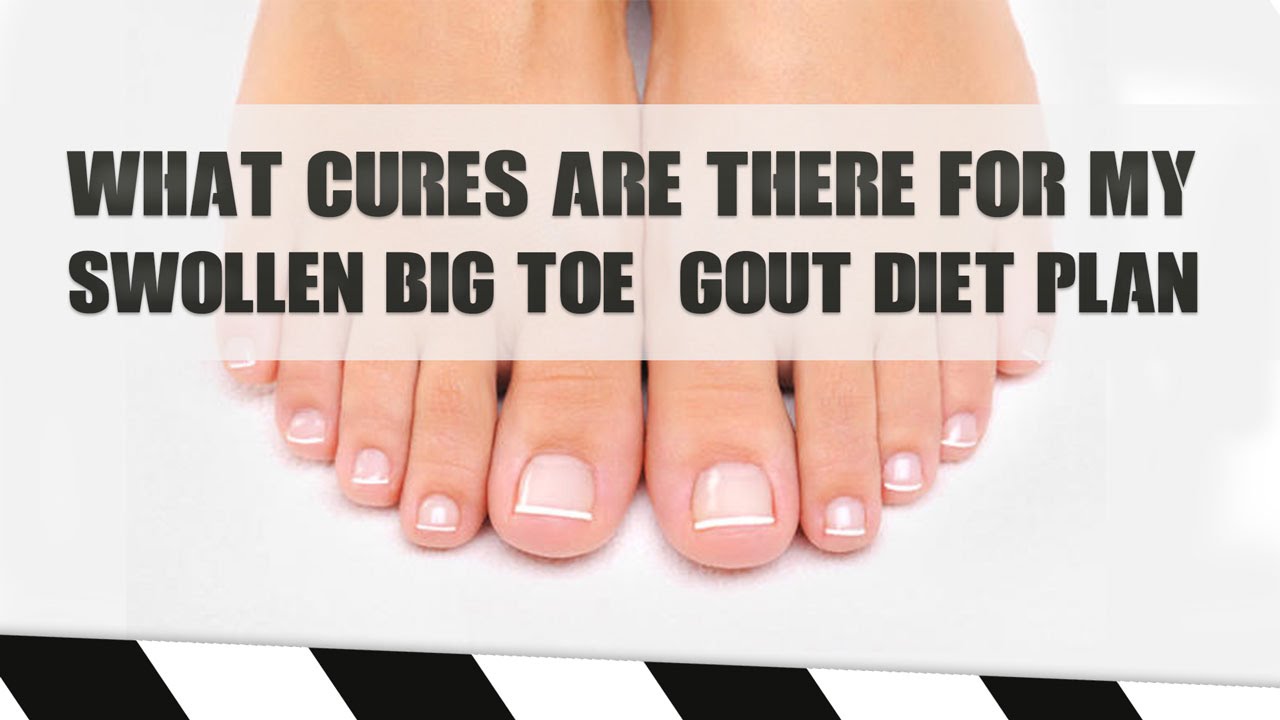 Foods Good For Gout To Relieve Your Swollen, Painful Big Toe