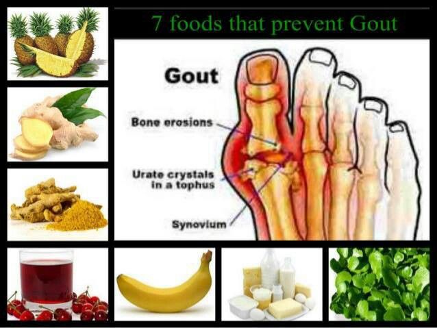 Foods that prevent gout