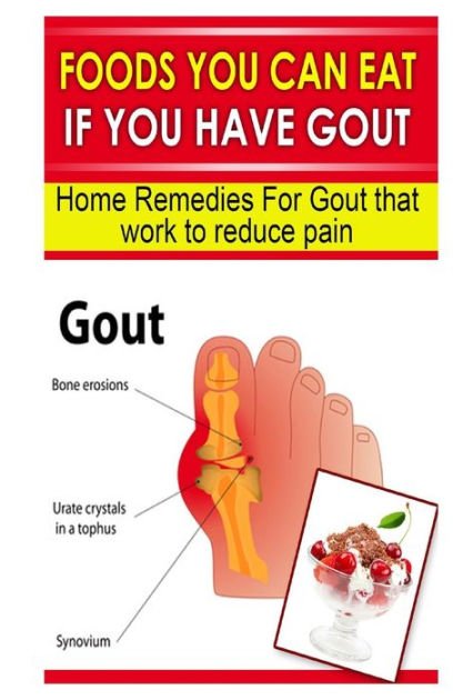 Foods You Can Eat If You Have Gout: Home Remedies for Gout That Work to ...