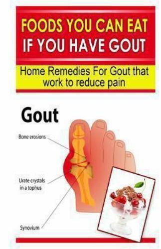 Foods You Can Eat If You Have Gout : Home Remedies for ...