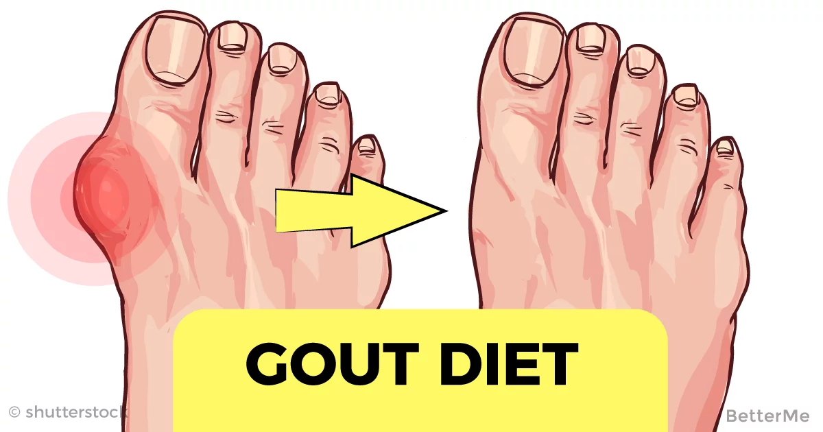 Gout Diet: You Should Really Avoid These Foods