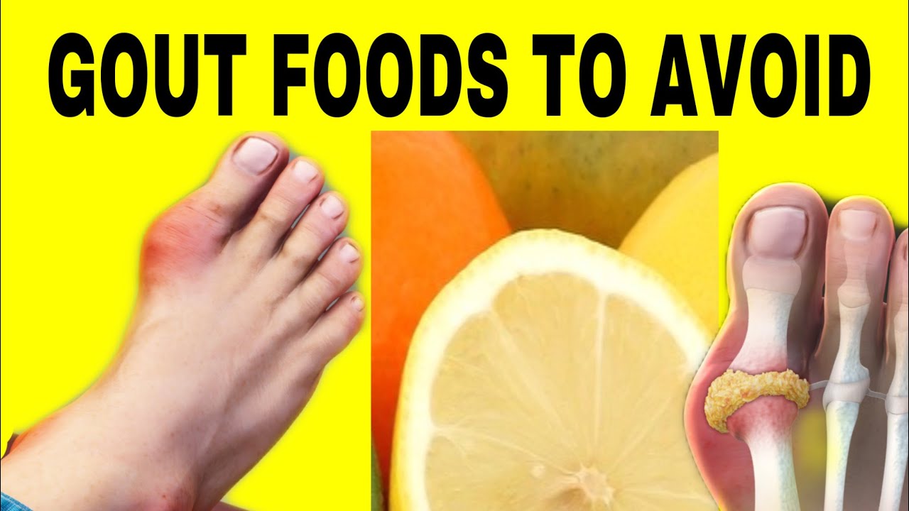 Gout foods to avoid