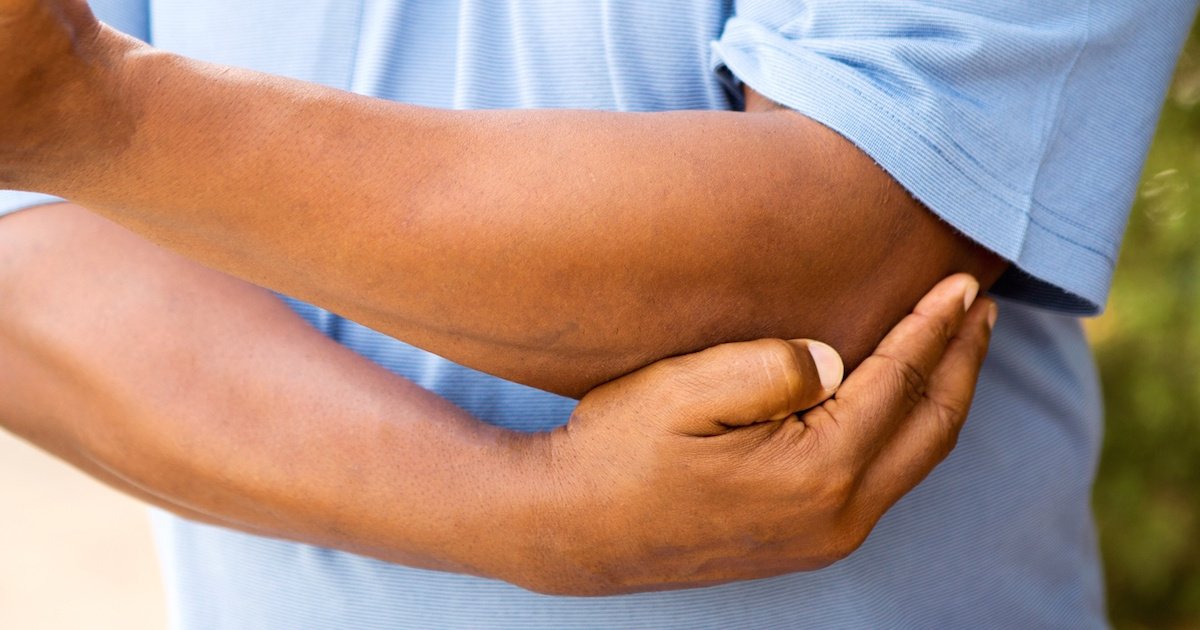 Gout in Elbow: What You Need to Know about Elbow Gout