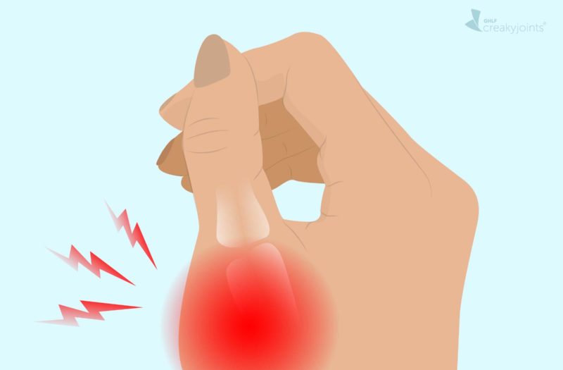 Gout in the Thumb: Symptoms, Causes, Treatments