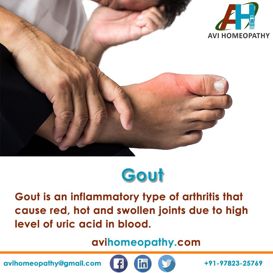 Gout is an inflammatory type of arthritis that cause red ...