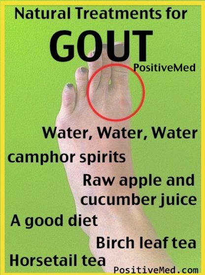 Gout Natural Treatments