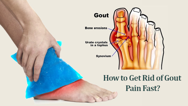 Gout Pain Relief: How to Get Rid of Gout Pain Fast