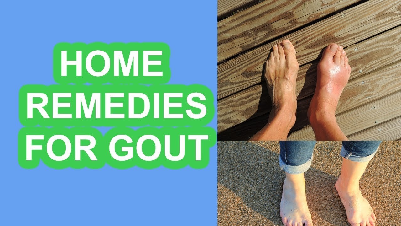 Gout Remedies at Home How to Get Rid of Gout Pain Fast Indian Home ...