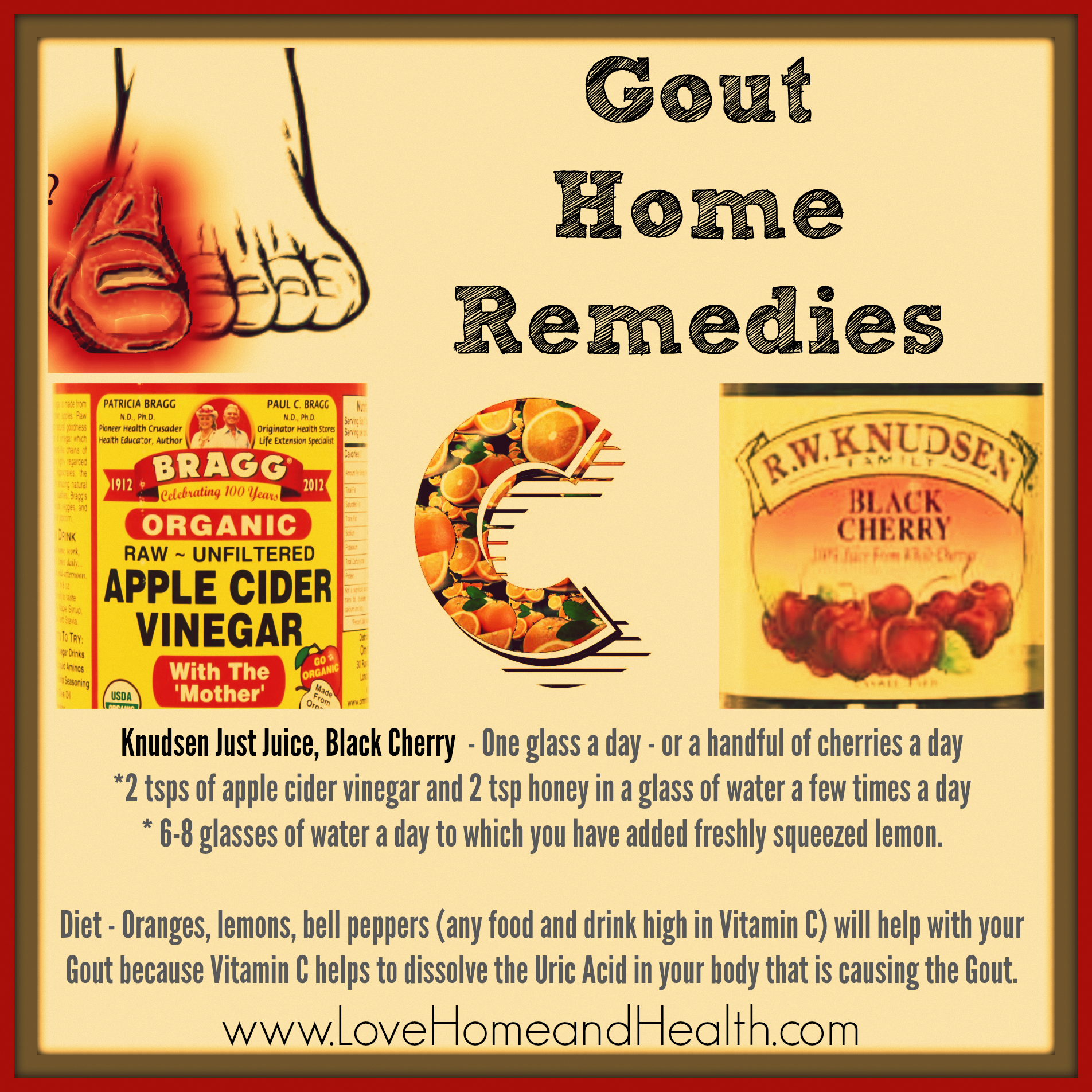 gout remedies at home