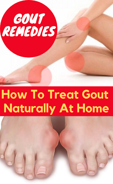 Gout Remedies