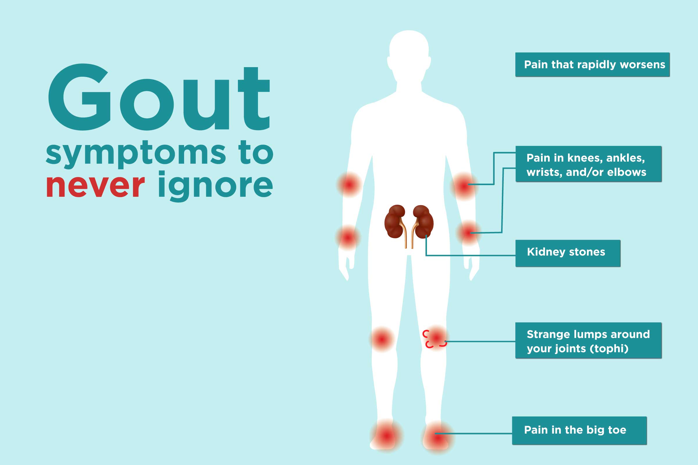 Gout Symptoms You Might Be Ignoring â CreakyJoints